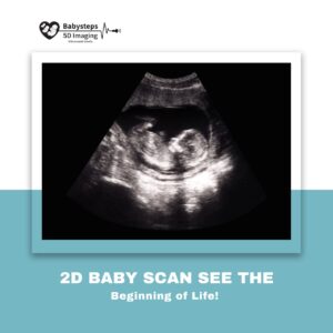 2D ultrasound Calgary showing baby’s heartbeat on monitor