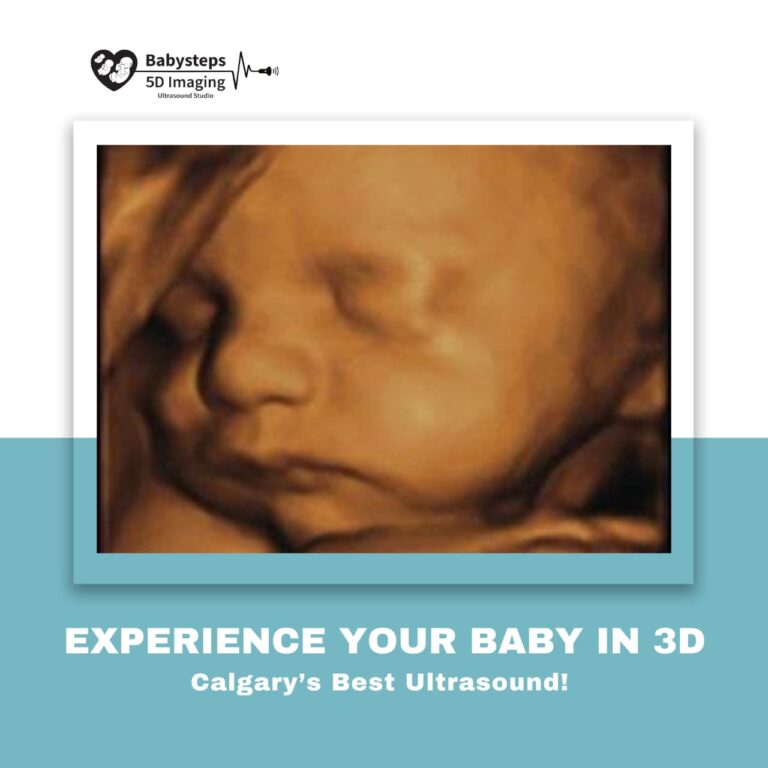 3D ultrasound image of a baby at Baby Steps clinic in Calgary, showing clear facial features.
