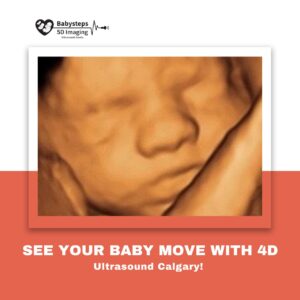 A pregnant woman viewing her baby’s movements during a 4D Ultrasound Calgary session at Baby Steps 5D