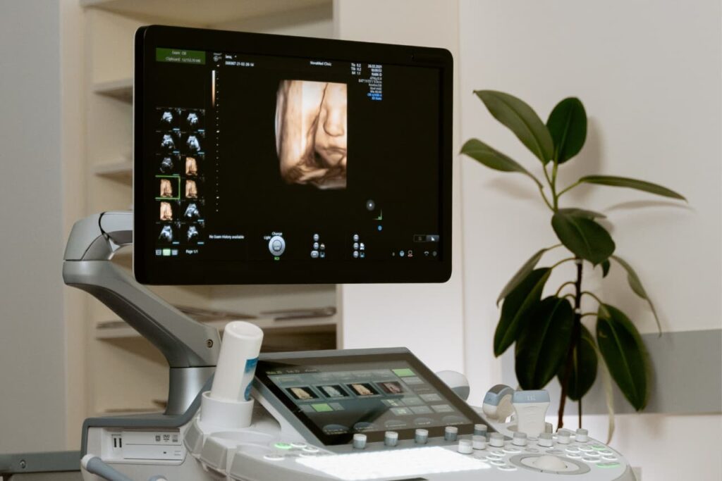 3D ultrasound image of a baby at Baby Steps clinic in Calgary, showing clear facial features.