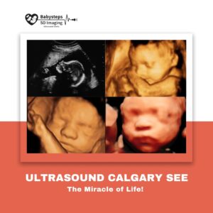 Ultrasound Calgary clinic providing clear and safe pregnancy scans